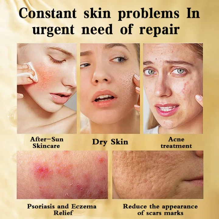 KNIYEA VC Soothing Toner 500ml KNIYEA VC Soothing Toner 500ml