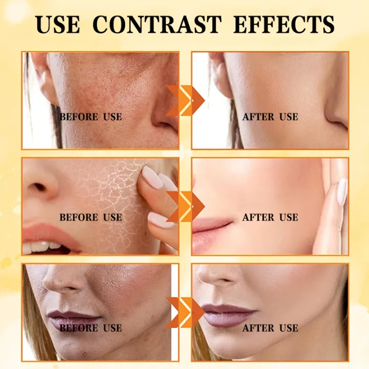 KNIYEA VC Soothing Toner 500ml KNIYEA VC Soothing Toner 500ml