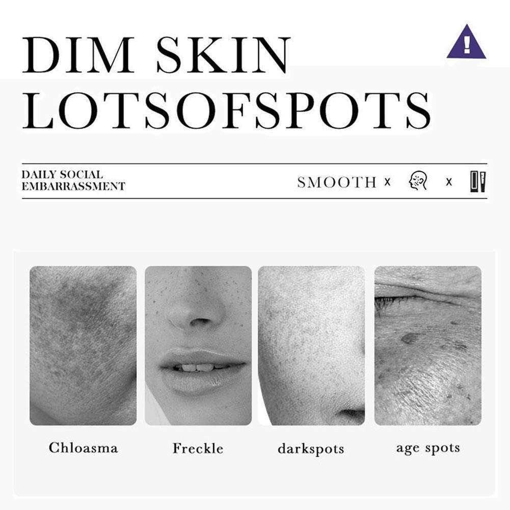 Dr Hancy White Spot Japan Cream Dr Hancy White Spot Japan Cream