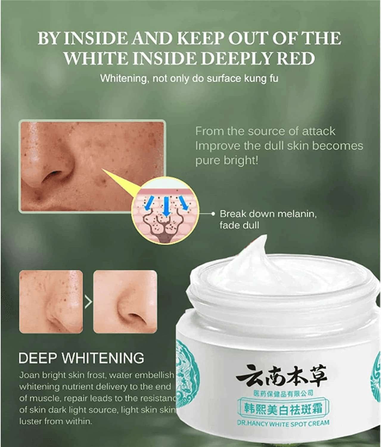 Dr Hancy White Spot Japan Cream Dr Hancy White Spot Japan Cream