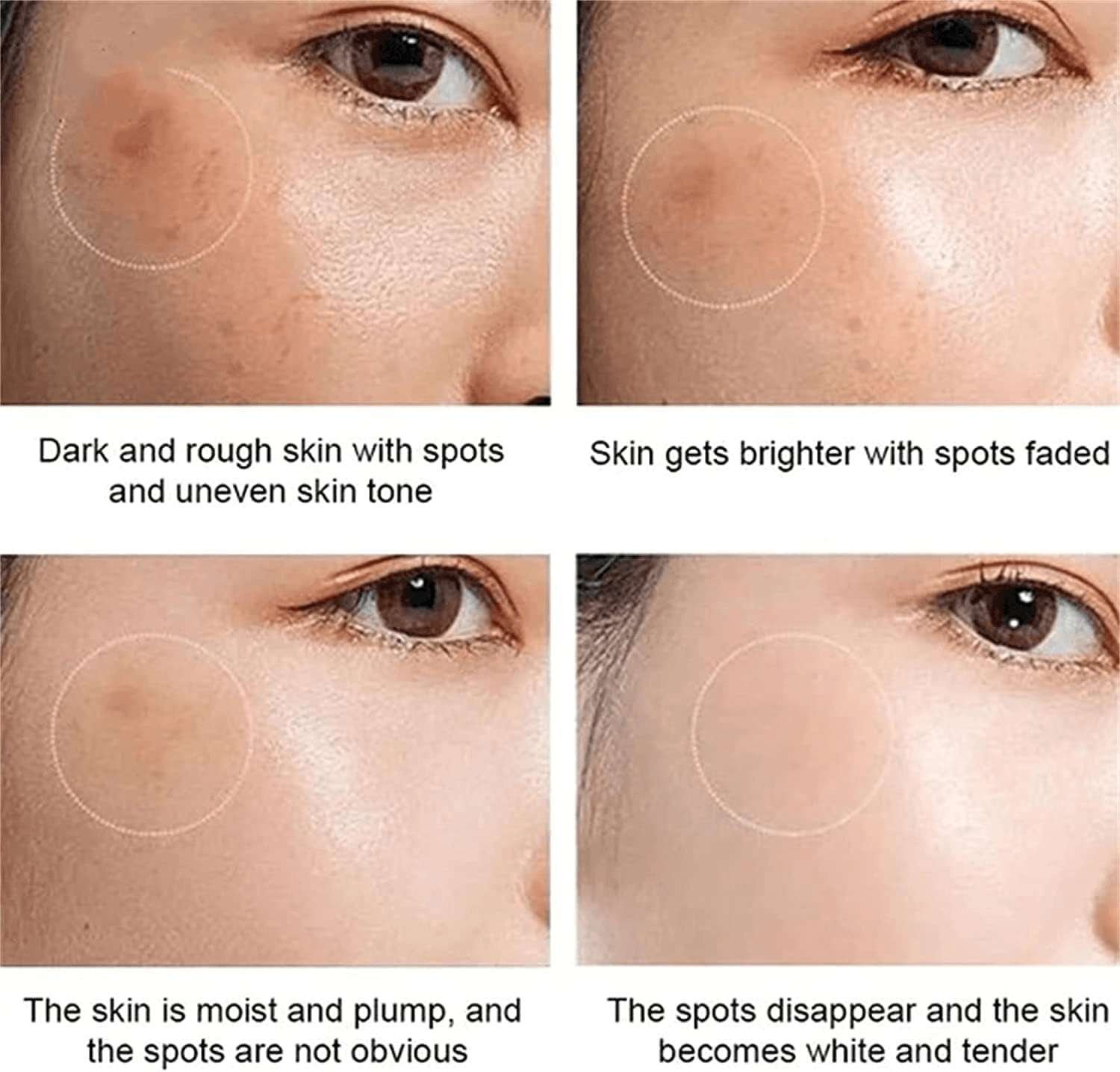 Dr Hancy White Spot Japan Cream Dr Hancy White Spot Japan Cream