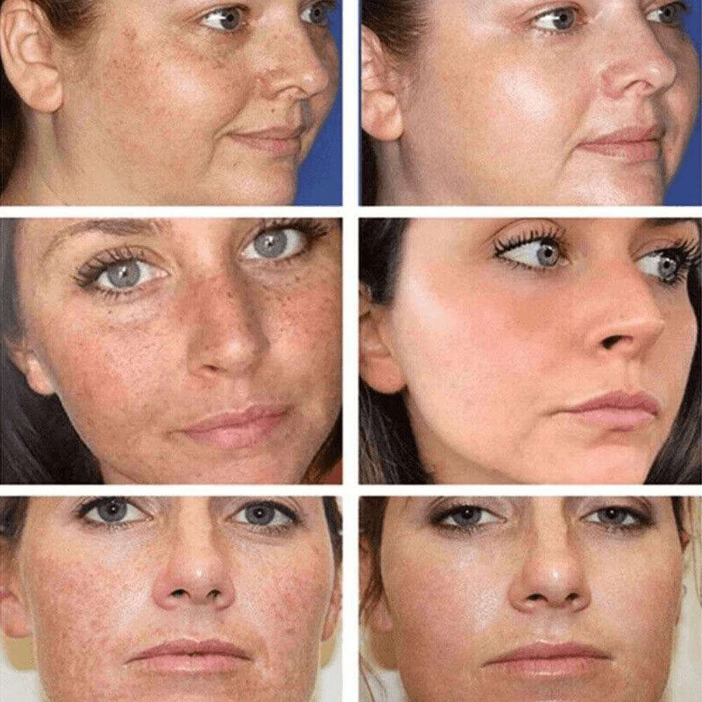 Dr Hancy White Spot Japan Cream Dr Hancy White Spot Japan Cream