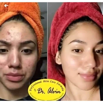 Dr. Alvin The Original Rejuvenating Set No.5