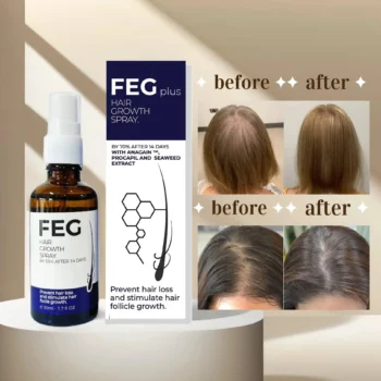 FEG Plus Hair Growth Spray – 50ml
