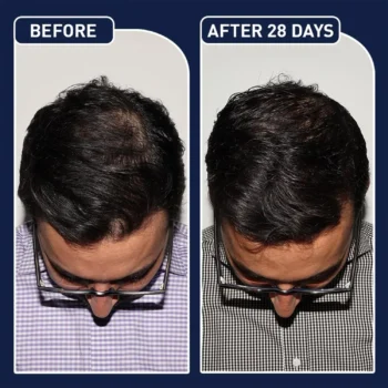 FEG Plus Hair Growth Spray – 50ml