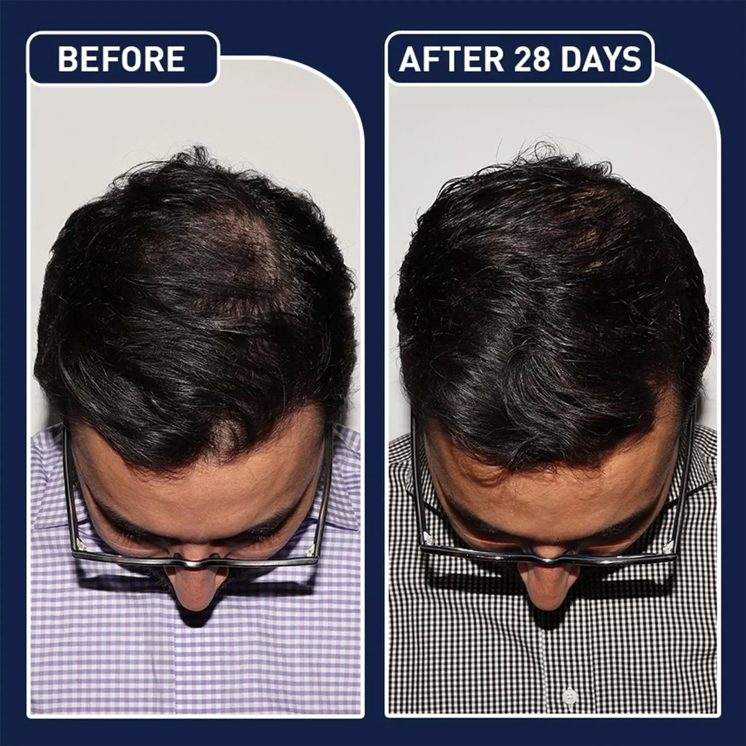 FEG Plus Hair Growth Spray – 50ml FEG Plus Hair Growth Spray – 50ml