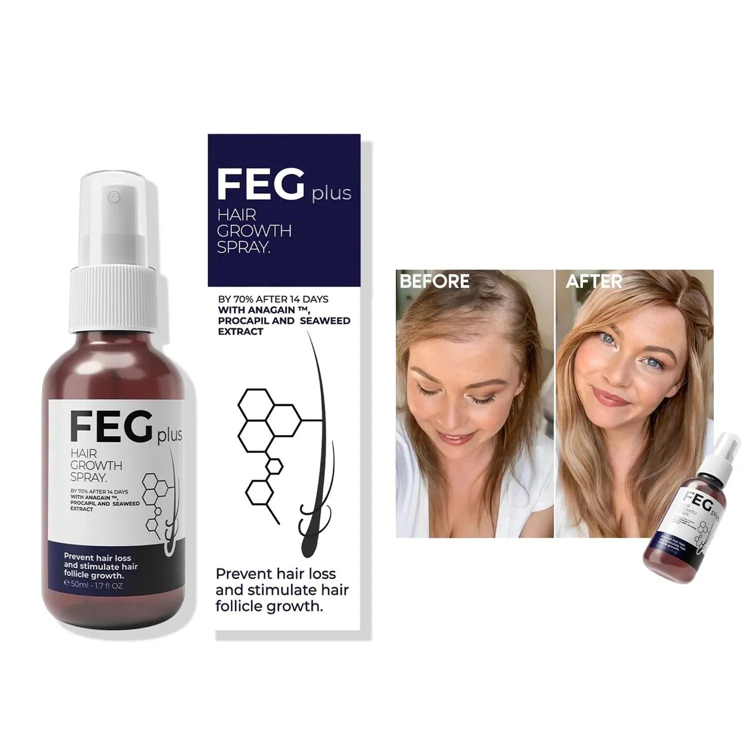 FEG Plus Hair Growth Spray – 50ml FEG Plus Hair Growth Spray – 50ml