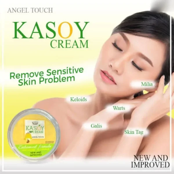 Kasoy Cream Warts Remover Angel Touch - 5g