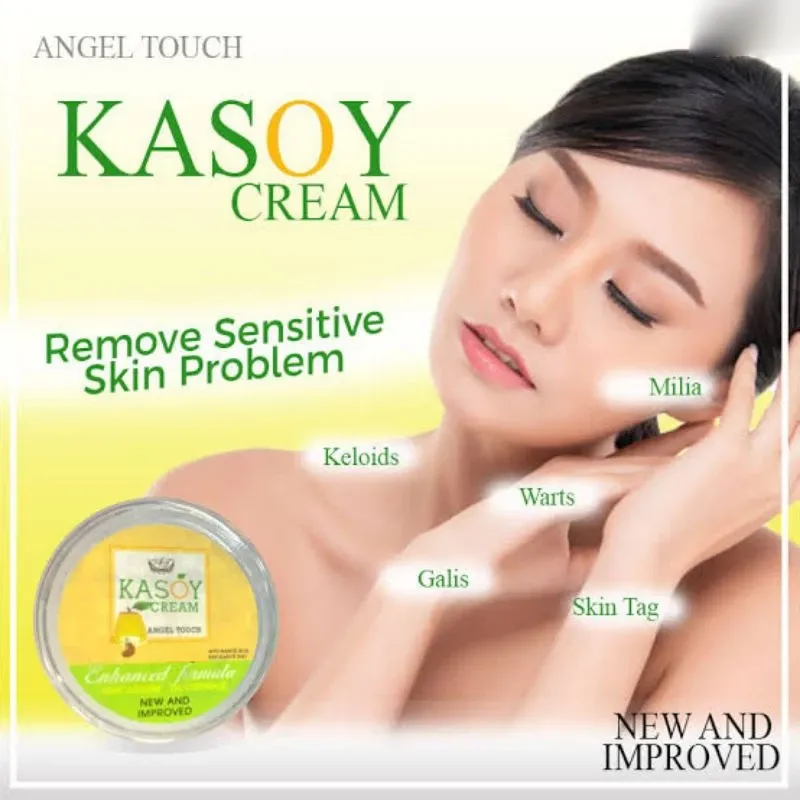 Kasoy Cream Warts Remover Angel Touch - 5g Kasoy Cream Warts Remover Angel Touch - 5g