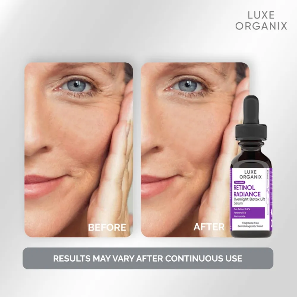 Luxe Organix Retinol Radiance Overnight Botox Lift Serum Luxe Organix Retinol Radiance Overnight Botox Lift Serum