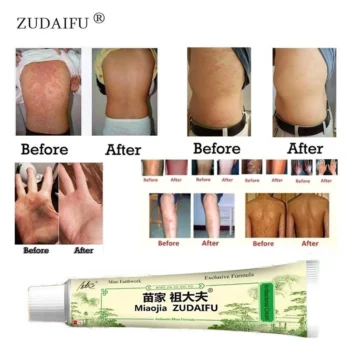 Miaojia Zudaifu Antibacterial Cream