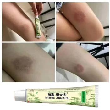 Miaojia Zudaifu Antibacterial Cream