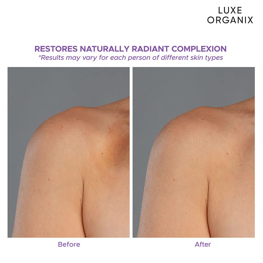 Retinol + Gluta Youthful Radiance Whitening Serum Lotion Retinol + Gluta Youthful Radiance Whitening Serum Lotion