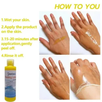 Skeen Care Extra Strength Peeling Lotion