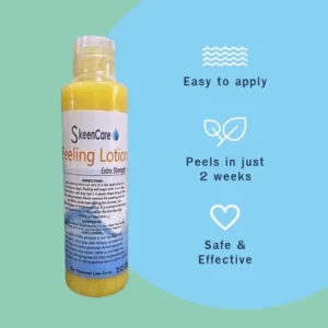 Skeen Care Extra Strength Peeling Lotion