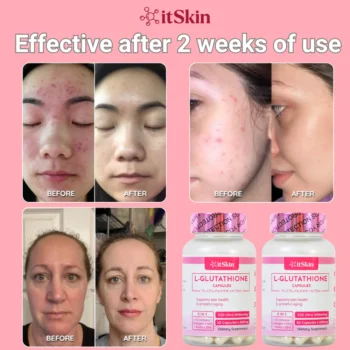 Itskin L-Glutathione Capsule with Collagen & Biotin