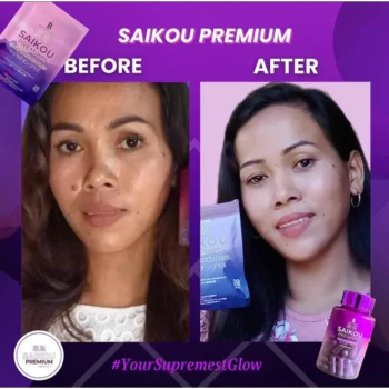 SAIKOU Premium Glutathione Plus