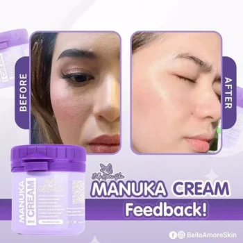 Bella Amore Skin Manuka Cream – Intensive Moisturizing & Skin Repair Cream (60ml) - Image 4