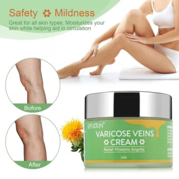 SEFUDUN VARICOSE VEINS CREAM 50g - Image 2